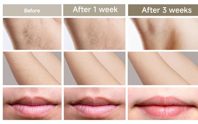 Stylique Glow™ Painless IPL Laser Hair Removal – 999,999 Flashes for Full-Body Radiance