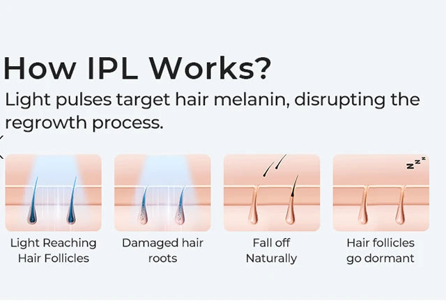 Stylique Glow™ Painless IPL Laser Hair Removal – 999,999 Flashes for Full-Body Radiance