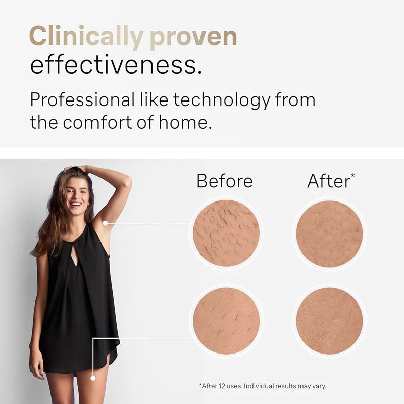 Stylique Glow™ Painless IPL Laser Hair Removal – 999,999 Flashes for Full-Body Radiance