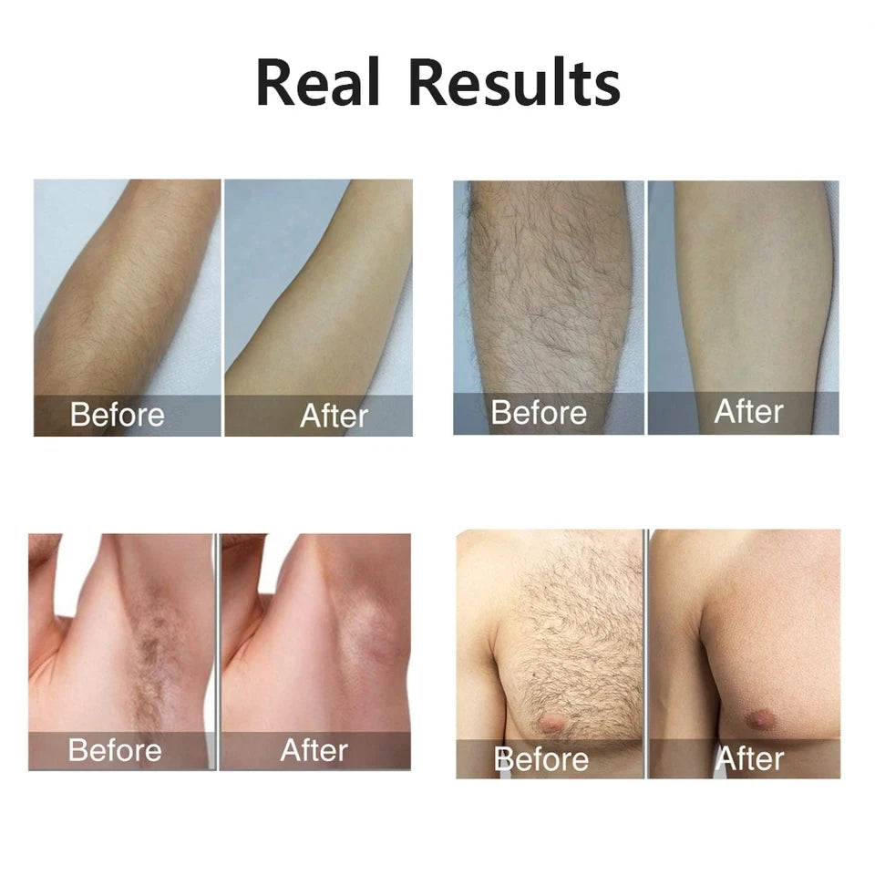 Stylique Glow™ 999,999 Flashes IPL Laser Epilator – Painless, Permanent Hair Removal for Face, Body & Bikini