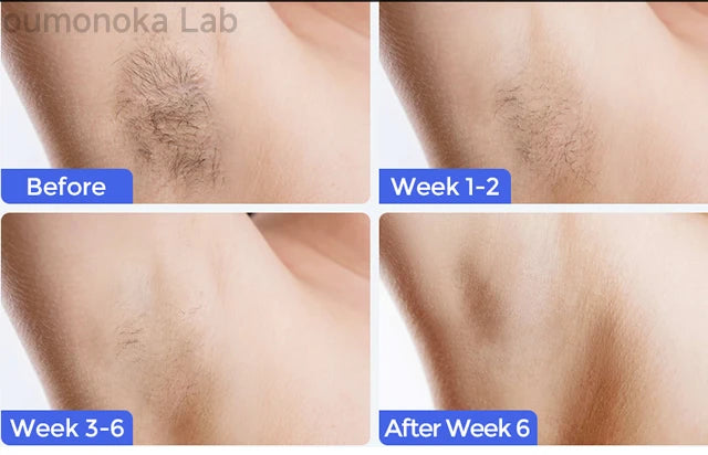 Stylique Glow™ Painless IPL Laser Hair Removal – 999,999 Flashes for Full-Body Radiance