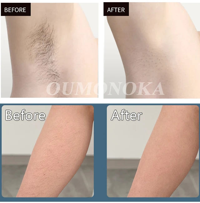 Stylique Glow™ Painless IPL Laser Hair Removal – 999,999 Flashes for Full-Body Radiance