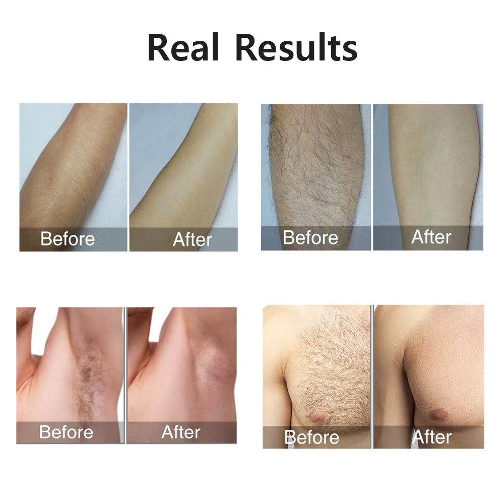 Stylique Glow™ 999,999 Flashes IPL Laser Epilator – Painless, Permanent Hair Removal for Face, Body & Bikini