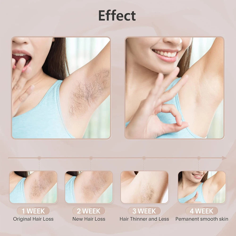 Stylique Glow™ 999,999 Flashes IPL Laser Epilator – Painless, Permanent Hair Removal for Face, Body & Bikini