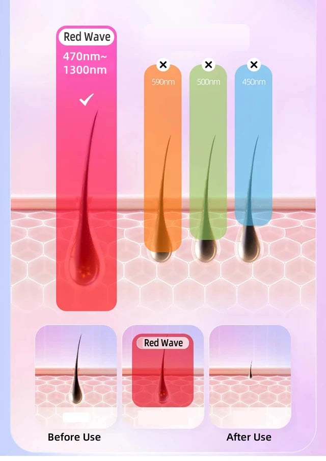 Stylique Glow™ Painless IPL Laser Hair Removal – 999,999 Flashes for Full-Body Radiance