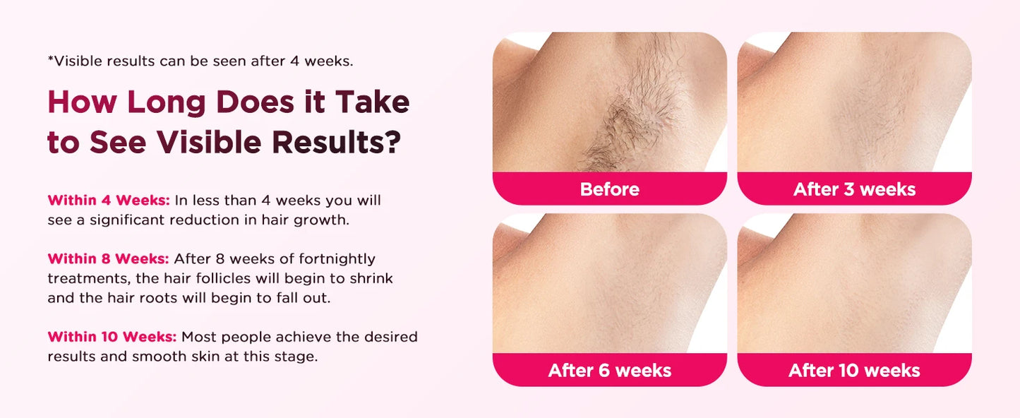 Stylique Glow™ IPL Laser Hair Removal Handset – 990,000 Flashes | Painless Permanent Smooth Skin