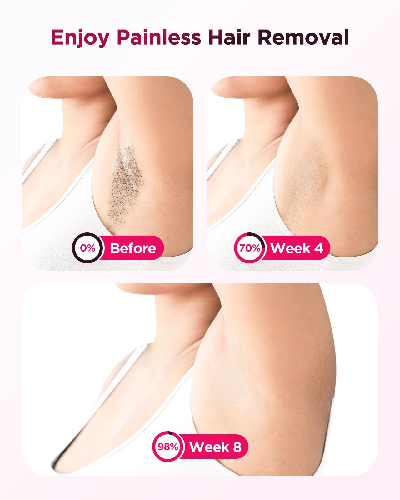 Stylique Glow™ IPL Laser Hair Removal Handset – 990,000 Flashes | Painless Permanent Smooth Skin