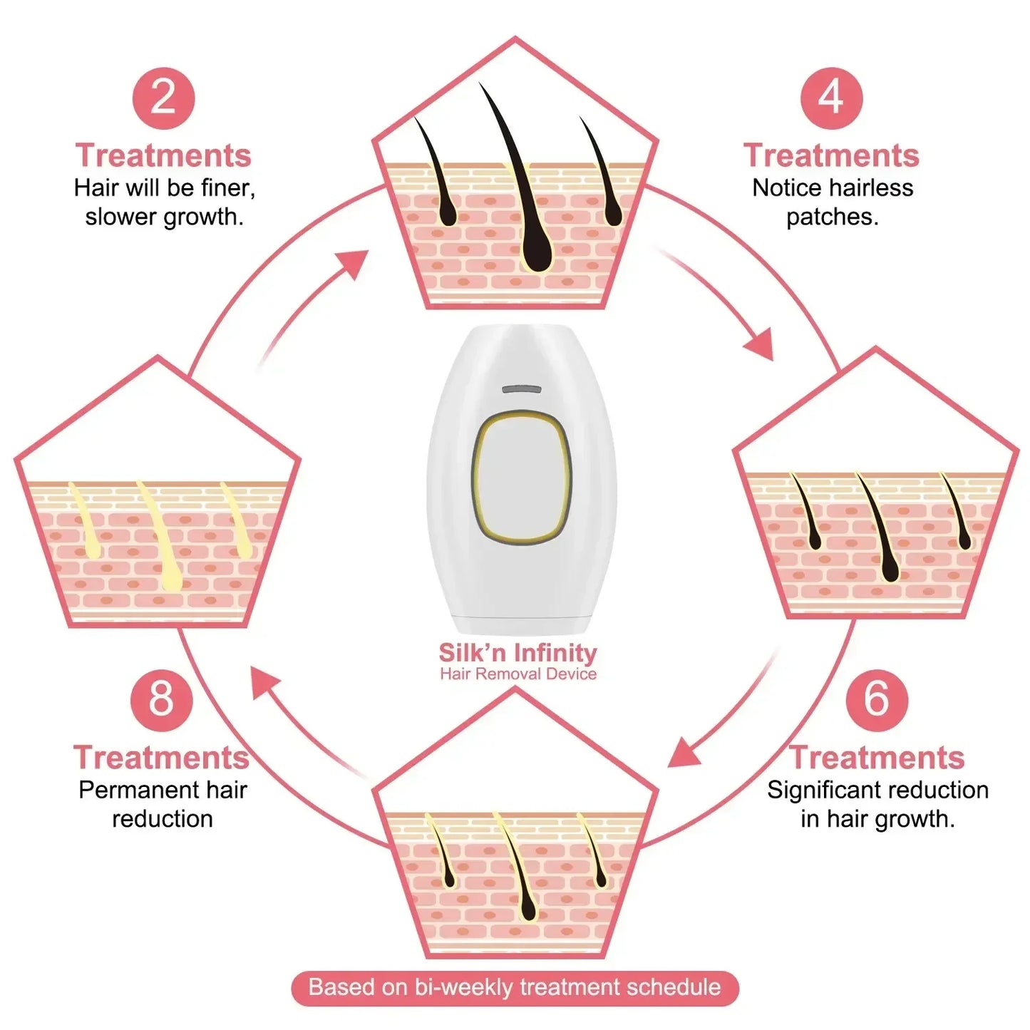 Stylique Glow™ Portable IPL Hair Removal Laser – 500,000 Flashes, Painless, Facial & Full Body Use