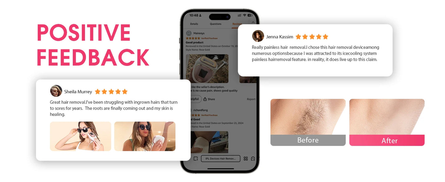 Stylique Glow IPL Laser Hair Removal – 990,000 Flashes for Smooth Skin