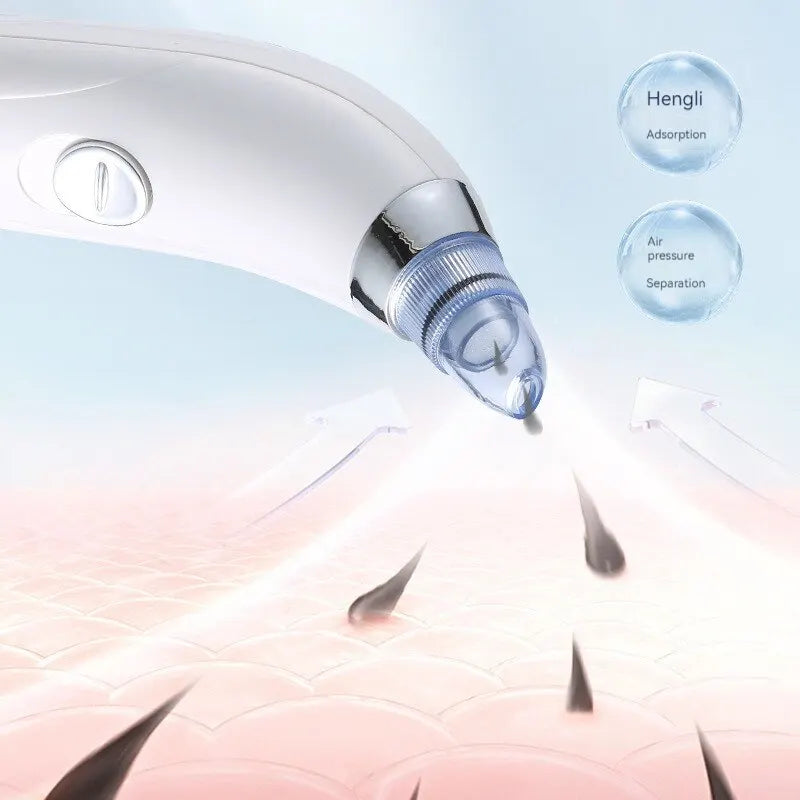 Stylique Glow™ Precision Pore Purifier – Luxury Blackhead Remover & Facial Cleansing Device