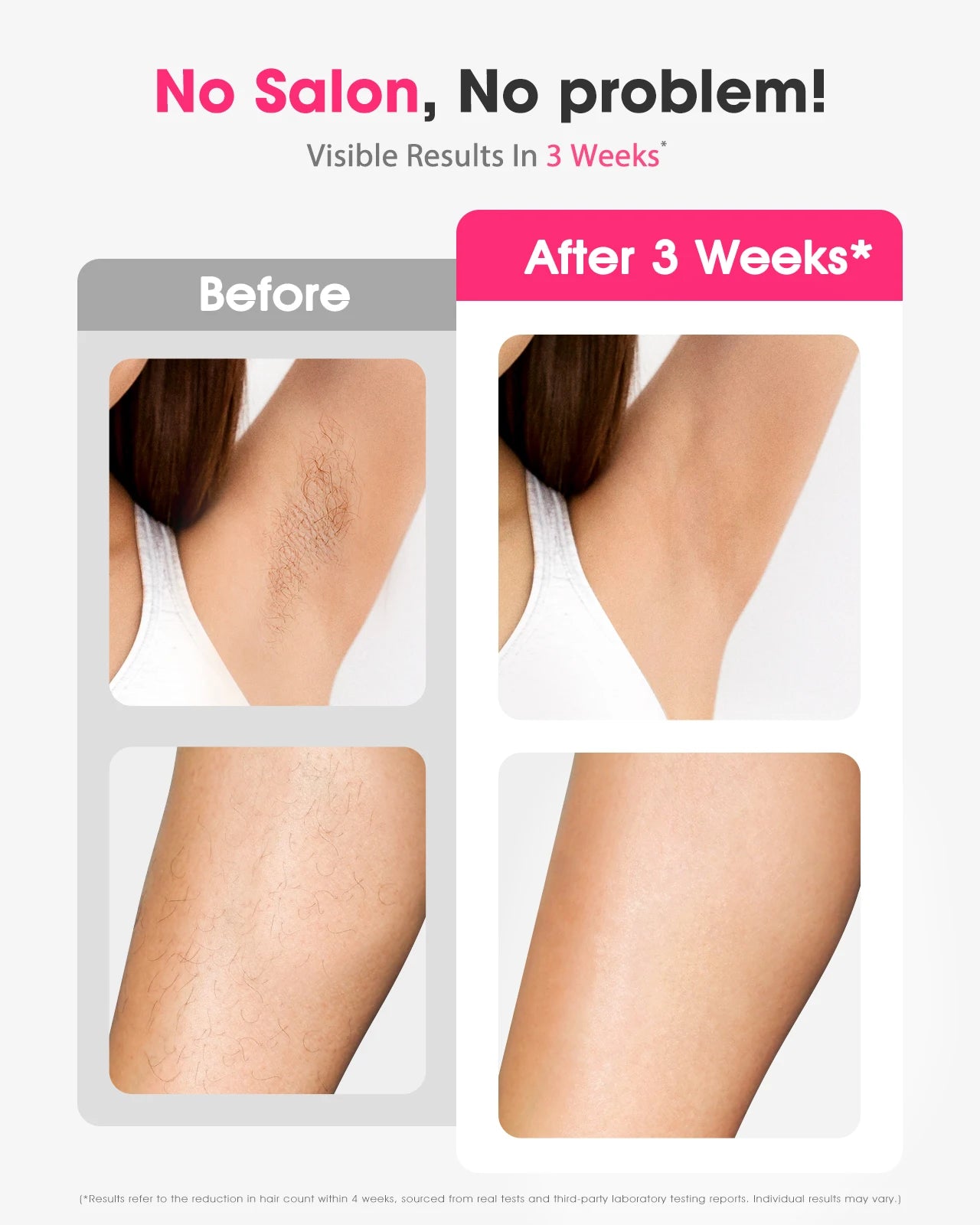 Stylique Glow IPL Laser Hair Removal – 990,000 Flashes for Smooth Skin