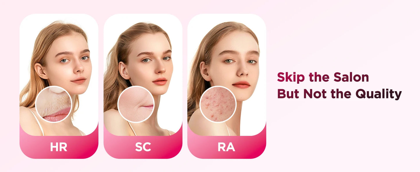 Stylique Glow™ IPL Laser Hair Removal Handset – 990,000 Flashes | Painless Permanent Smooth Skin